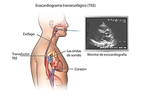 PCardio_20140402_v0_003_sp